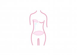 muscle-sparing-free-flap-mastectomy-procedure